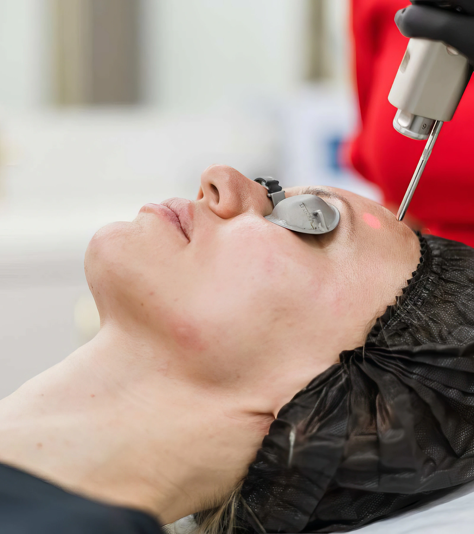 Rajeunissement laser